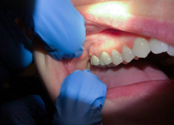 Best Walk-In Emergency Dental Services in Rosemount, OH